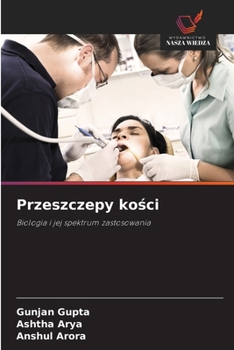 Paperback Przeszczepy ko&#347;ci [Polish] Book