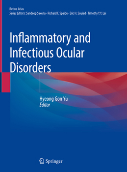 Hardcover Inflammatory and Infectious Ocular Disorders Book