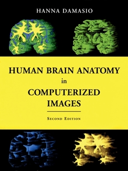 Hardcover Human Brain Anatomy in Computerized Images Book