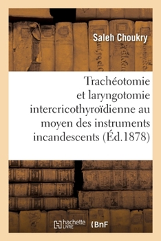 Paperback de la Trachéotomie Et de la Laryngotomie Intercricothyroïdienne: Au Moyen Des Instruments Incandescents [French] Book