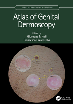 Hardcover Atlas of Genital Dermoscopy Book