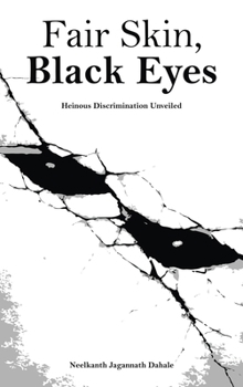 Hardcover Fair Skin, Black Eyes: Heinous Discrimination Unveiled Book