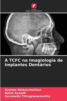 Paperback A TCFC na Imagiologia de Implantes Dentários [Portuguese] Book