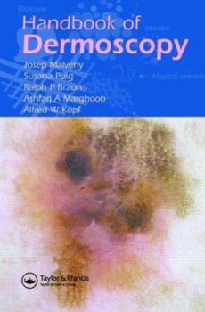 Paperback Handbook of Dermoscopy Book