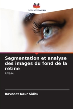 Segmentation et analyse des images du fond de la rétine (French Edition)