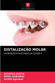 Paperback Distalização Molar [Portuguese] Book