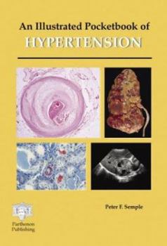 Paperback An Illustrated Pocketbook of Hypertension Book