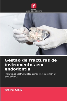 Paperback Gestão de fracturas de instrumentos em endodontia [Portuguese] Book