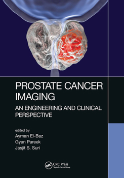 Paperback Prostate Cancer Imaging: An Engineering and Clinical Perspective Book