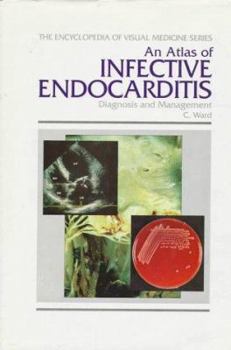 Hardcover An Atlas of Infective Endocarditis: Diagnosis and Management Book