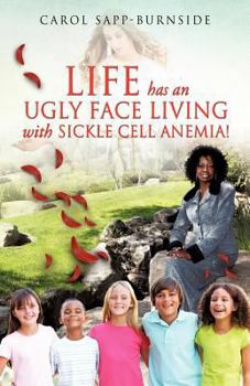 Paperback Life Has an Ugly Face Living with Sickle Cell Anemia! Book
