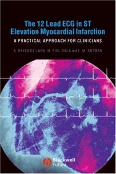 Paperback The 12-Lead ECG in ST Elevation Myocardial Infarction: A Practical Approach for Clinicians Book