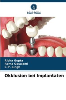 Paperback Okklusion bei Implantaten [German] Book