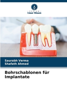 Paperback Bohrschablonen für Implantate [German] Book