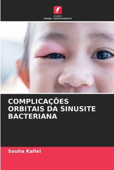 Paperback Complicações Orbitais Da Sinusite Bacteriana [Portuguese] Book