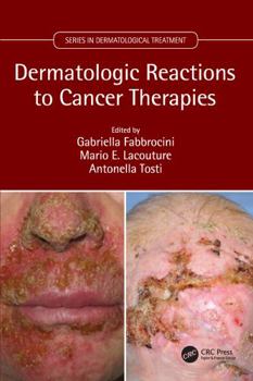 Hardcover Dermatologic Reactions to Cancer Therapies Book
