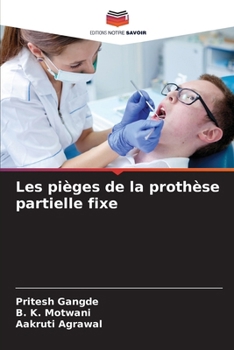 Paperback Les pièges de la prothèse partielle fixe [French] Book