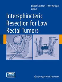 Paperback Intersphincteric Resection for Low Rectal Tumors Book