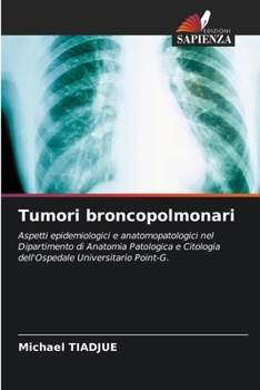 Paperback Tumori broncopolmonari [Italian] Book
