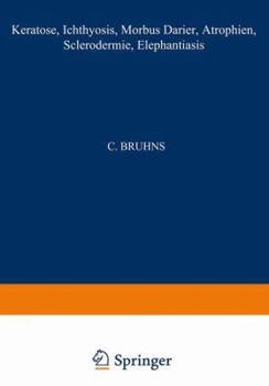 Paperback Keratosen; Ichthyosis; Morbus Darier; Atrophien; Sclerodermie; Elephantiasis [German] Book