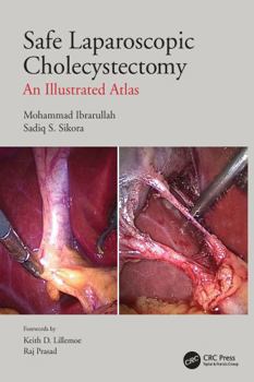 Paperback Safe Laparoscopic Cholecystectomy: An Illustrated Atlas Book