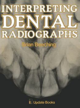 Paperback Interpreting Dental Radiographs Book