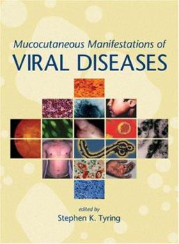 Hardcover Mucocutaneous Manifestations of Viral Diseases Book