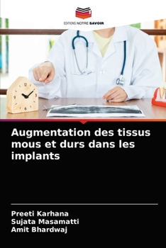 Paperback Augmentation des tissus mous et durs dans les implants [French] Book