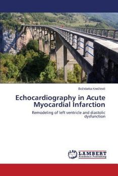 Paperback Echocardiography in Acute Myocardial Infarction Book
