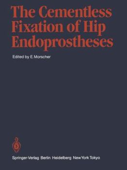 Paperback The Cementless Fixation of Hip Endoprostheses Book