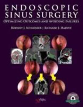 Hardcover Endoscopic Sinus Surgery: Optimizing Outcomes and Avoiding Failures Book