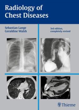 Hardcover Radiology of Chest Diseases Book