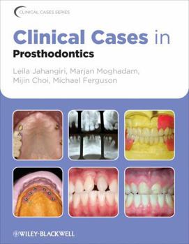 Paperback Clinical Cases in Prosthodontics Book