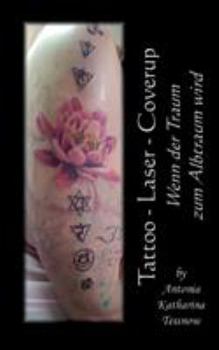 Paperback Tattoo - Laser - Cover Up: Wenn der Traum zum Albtraum wird [German] Book