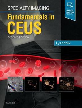 Hardcover Specialty Imaging: Fundamentals of Ceus Book