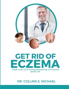 Paperback Get Rid of Eczema: Guide to get rid of eczema permanently and improve quality life Book