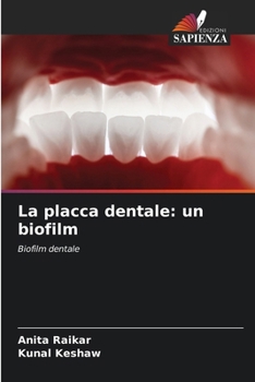 La placca dentale: un biofilm (Italian Edition)