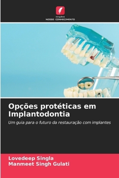 Paperback Opções protéticas em Implantodontia [Portuguese] Book