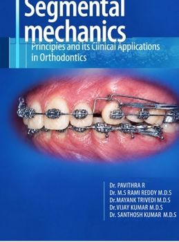 Segmental mechanics: principles and its clinical applications in orthodontics