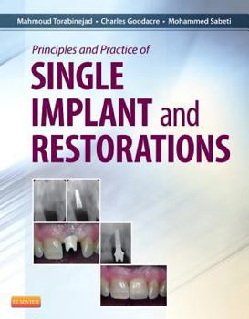 Hardcover Principles and Practice of Single Implant and Restoration Book