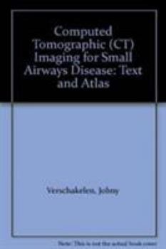 Paperback Computed Tomographic (Ct) Imaging for Small Airways Disease: Text and Atlas Book