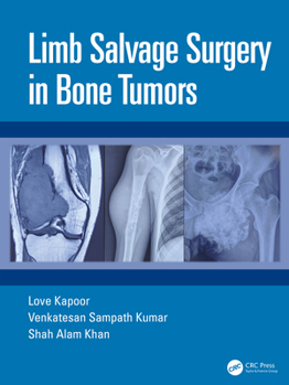 Hardcover Limb Salvage Surgery in Bone Tumors Book