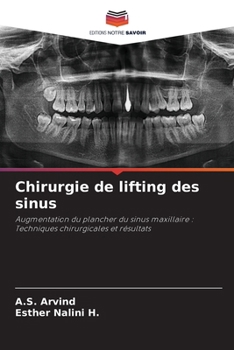 Paperback Chirurgie de lifting des sinus [French] Book