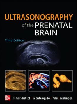 Hardcover Ultrasonography of the Prenatal Brain Book