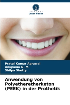 Paperback Anwendung von Polyetheretherketon (PEEK) in der Prothetik [German] Book