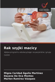 Paperback Rak szyjki macicy [Polish] Book