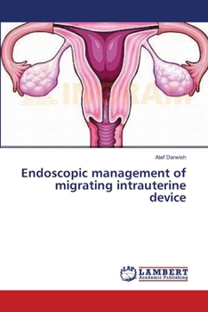 Paperback Endoscopic management of migrating intrauterine device Book