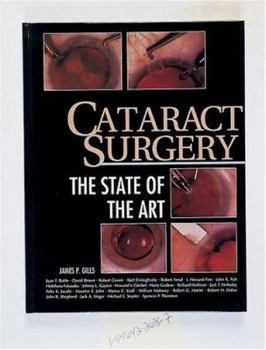 Hardcover Cataract Surgery: The State of the Art Book
