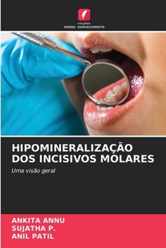 Paperback Hipomineralização DOS Incisivos Molares [Portuguese] Book