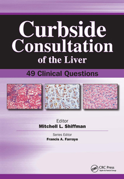 Paperback Curbside Consultation of the Liver: 49 Clinical Questions Book